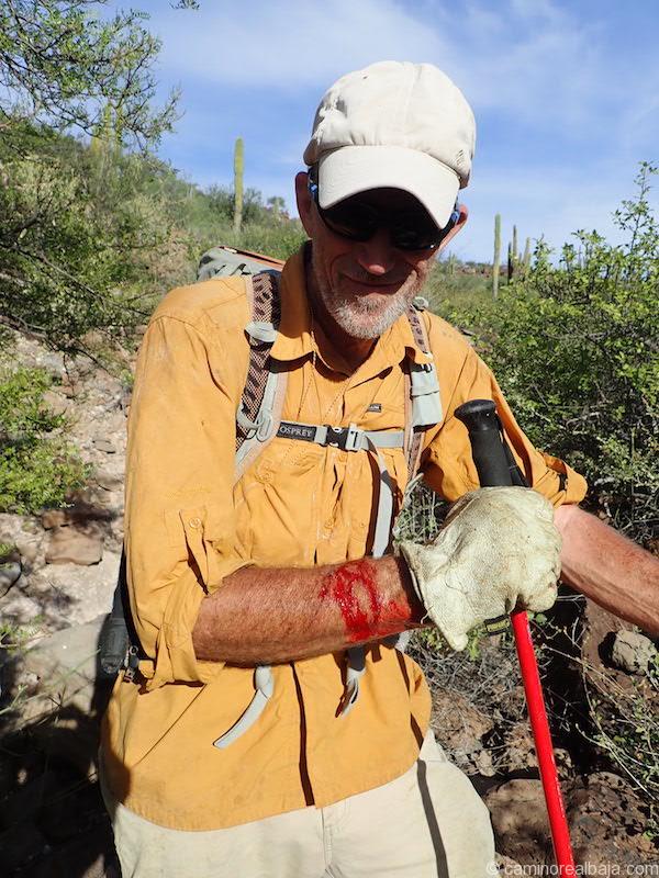 Kevin's arm is bleeding due to uña de gato thorns on the mission trail